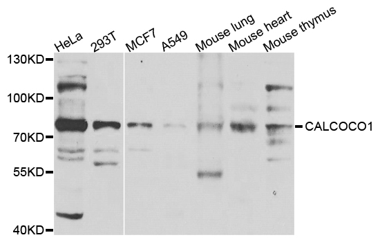 CALCOCO1 / CoCoa Antibody - Western blot analysis of extracts of various cells.