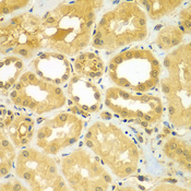 CALCOCO1 / CoCoa Antibody - Immunohistochemistry of paraffin-embedded human kidney tissue.