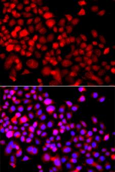 CALCOCO1 / CoCoa Antibody - Immunofluorescence analysis of A549 cells.