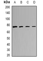 CALCOCO1 / CoCoa Antibody - Western blot analysis of CALCOCO1 expression in MCF7 (A); A549 (B); mouse lung (C); mouse heart (D) whole cell lysates.