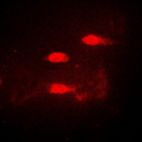 CALCOCO1 / CoCoa Antibody - Immunofluorescent analysis of CALCOCO1 staining in A549 cells. Formalin-fixed cells were permeabilized with 0.1% Triton X-100 in TBS for 5-10 minutes and blocked with 3% BSA-PBS for 30 minutes at room temperature. Cells were probed with the primary antibody in 3% BSA-PBS and incubated overnight at 4 deg C in a humidified chamber. Cells were washed with PBST and incubated with a DyLight 594-conjugated secondary antibody (red) in PBS at room temperature in the dark.
