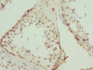 CALCOCO1 / CoCoa Antibody - Immunohistochemistry of paraffin-embedded human testis tissue at dilution 1:100