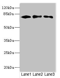 CALCOCO1 / CoCoa Antibody - Western blot All Lanes: CALCOCO1antibody at 1.61ug/ml Lane 1 : 293T whole cell lysate Lane 2 : MCF7 whole cell lysate Lane 3 : Mouse lung tissue Secondary Goat polyclonal to Rabbit IgG at 1/10000 dilution Predicted band size: 78,71,68 kDa Observed band size: 77 kDa
