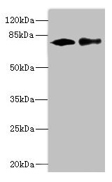 CALCOCO1 / CoCoa Antibody - Western blot All lanes: CALCOCO1 antibody at 1.61µg/ml Lane 1: 293T whole cell lysate Lane 2: MCF-7 whole cell lysate Secondary Goat polyclonal to rabbit IgG at 1/10000 dilution Predicted band size: 78, 71, 68 kDa Observed band size: 78 kDa