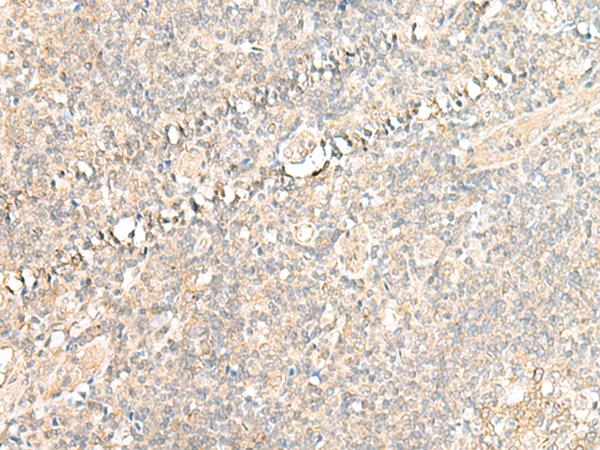 CALCOCO1 / CoCoa Antibody - Immunohistochemistry of paraffin-embedded Human tonsil tissue  using CALCOCO1 Polyclonal Antibody at dilution of 1:50(×200)