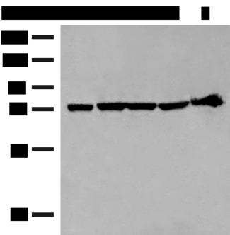 CALCOCO1 / CoCoa Antibody - Western blot analysis of 293T cell and Mouse heart tissue lysates  using CALCOCO1 Polyclonal Antibody at dilution of 1:300