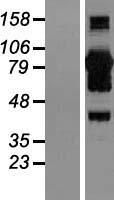 CALCOCO1 / CoCoa Protein - Western validation with an anti-DDK antibody * L: Control HEK293 lysate R: Over-expression lysate