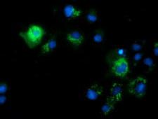 CALCOCO2 Antibody - Anti-CALCOCO2 mouse monoclonal antibody immunofluorescent staining of COS7 cells transiently transfected by pCMV6-ENTRY CALCOCO2.