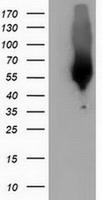 CALCOCO2 Antibody - HEK293T cells were transfected with the pCMV6-ENTRY control (Left lane) or pCMV6-ENTRY CALCOCO2 (Right lane) cDNA for 48 hrs and lysed. Equivalent amounts of cell lysates (5 ug per lane) were separated by SDS-PAGE and immunoblotted with anti-CALCOCO2.
