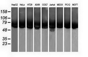 CALCOCO2 Antibody - Western blot of extracts (35 ug) from 9 different cell lines by using anti-CALCOCO2 monoclonal antibody.