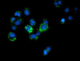 CALCOCO2 Antibody - Anti-CALCOCO2 mouse monoclonal antibody immunofluorescent staining of COS7 cells transiently transfected by pCMV6-ENTRY CALCOCO2.