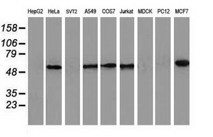 CALCOCO2 Antibody - Western blot of extracts (35 ug) from 9 different cell lines by using anti-CALCOCO2 monoclonal antibody.