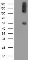 CALCOCO2 Antibody - HEK293T cells were transfected with the pCMV6-ENTRY control (Left lane) or pCMV6-ENTRY CALCOCO2 (Right lane) cDNA for 48 hrs and lysed. Equivalent amounts of cell lysates (5 ug per lane) were separated by SDS-PAGE and immunoblotted with anti-CALCOCO2.