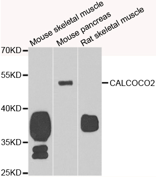CALCOCO2 Antibody - Western blot analysis of extracts of various cell lines.