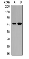 CALCOCO2 Antibody - Western blot analysis of CALCOCO2 expression in mouse pancreas (A); rat skeletal muscle (B) whole cell lysates.