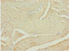 CALCOCO2 Antibody - Immunohistochemistry of paraffin-embedded human skeletal muscle tissue at dilution 1:100