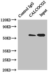 CALCOCO2 Antibody - Immunoprecipitating CALCOCO2 in HeLa whole cell lysate Lane 1: Rabbit monoclonal IgG(1ug)instead of product in HeLa whole cell lysate.For western blotting, a HRP-conjugated anti-rabbit IgG, specific to the non-reduced form of IgG was used as the Secondary antibody (1/50000) Lane 2: product(4ug)+ HeLa whole cell lysate(500ug) Lane 3: HeLa whole cell lysate (20ug)
