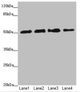 CALCOCO2 Antibody - Western blot All Lanes: CALCOCO2 antibody at 3.36ug/ml Lane 1: Hela whole cell lysate Lane 2: Jurkat whole cell lysate Lane 3: 293T whole cell lysate Lane 4: Raji whole cell lysate Secondary Goat polyclonal to Rabbit IgG at 1/10000 dilution Predicted band size: 53,48,55,56,44 kDa Observed band size: 52 kDa