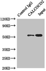 CALCOCO2 Antibody - Immunoprecipitating CALCOCO2 in HeLa whole cell lysate Lane 1: Rabbit monoclonal IgG(1ug)instead of product in HeLa whole cell lysate.For western blotting, a HRP-conjugated anti-rabbit IgG, specific to the non-reduced form of IgG was uses the Secondary antibody (1/50000) Lane 2: product(4ug)+ HeLa whole cell lysate(500ug) Lane 3: HeLa whole cell lysate (20ug)