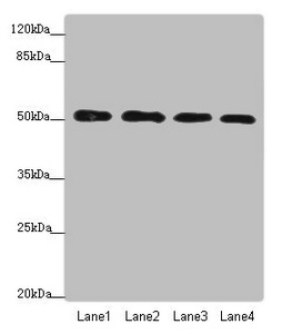 CALCOCO2 Antibody - Western blot All Lanes: CALCOCO2 antibody at 3.66ug/ml Lane 1: Hela whole cell lysate Lane 2: Jurkat whole cell lysate Lane 3: 293T whole cell lysate Lane 4: Raji whole cell lysate Secondary Goat polyclonal to Rabbit IgG at 1/10000 dilution Predicted band size: 53,48,55,56,44 kDa Observed band size: 52 kDa