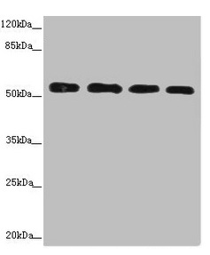 CALCOCO2 Antibody - Western blot All lanes: CALCOCO2 antibody at 3.66µg/ml Lane 1: Hela whole cell lysate Lane 2: Jurkat whole cell lysate Lane 3: 293T whole cell lysate Lane 4: Raji whole cell lysate Secondary Goat polyclonal to rabbit IgG at 1/10000 dilution Predicted band size: 53, 48, 55, 56, 44 kDa Observed band size: 56 kDa