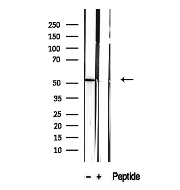 CALCOCO2 Antibody - Western blot analysis of extracts of rat skeletal muscle tissue using CALCOCO2 antibody.