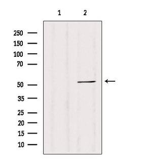 CALCOCO2 Antibody - Western blot analysis of extracts of 293 cells using CALCOCO2 antibody. Lane 1 was treated with the blocking peptide.