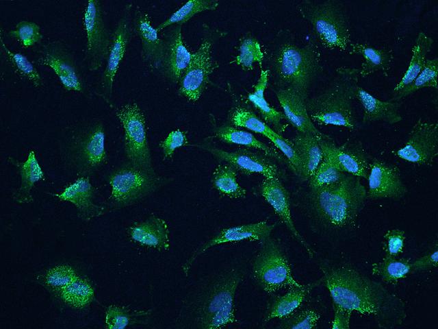 CALCOCO2 Antibody - Immunofluorescence staining of CALCOCO2 in U251MG cells. Cells were fixed with 4% PFA, permeabilzed with 0.1% Triton X-100 in PBS, blocked with 10% serum, and incubated with rabbit anti-Human CALCOCO2 polyclonal antibody (dilution ratio 1:200) at 4°C overnight. Then cells were stained with the Alexa Fluor 488-conjugated Goat Anti-rabbit IgG secondary antibody (green) and counterstained with DAPI (blue). Positive staining was localized to Cytoplasm.