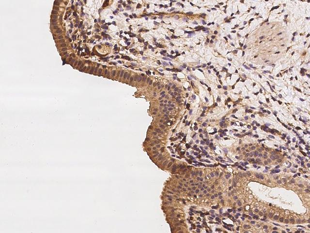 CALCOCO2 Antibody - Immunochemical staining of human CALCOCO2 in human gallbladder with rabbit polyclonal antibody at 1:100 dilution, formalin-fixed paraffin embedded sections.