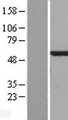 CALCOCO2 Protein - Western validation with an anti-DDK antibody * L: Control HEK293 lysate R: Over-expression lysate