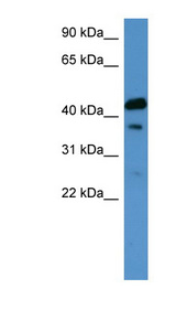CALCR / Calcitonin Receptor Antibody - CALCR / Calcitonin Receptor antibody Western blot of Fetal Kidney lysate.  This image was taken for the unconjugated form of this product. Other forms have not been tested.