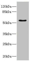 CALCR / Calcitonin Receptor Antibody - Western blot All Lanes: CALCRantibody IgG at 5.24ug/ml+ Rat heart tissue Secondary Goat polyclonal to rabbit IgG at 1/10000 dilution Predicted band size: 60,56,50,52,35,33 kDa Observed band size: 59 kDa