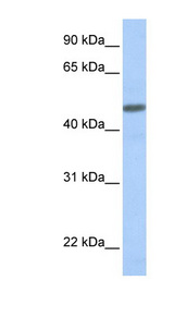 CALCRL / CGRP Receptor Antibody - CALCRL antibody Western blot of Fetal Muscle lysate. This image was taken for the unconjugated form of this product. Other forms have not been tested.