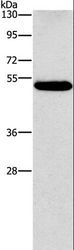 CALCRL / CGRP Receptor Antibody - Western blot analysis of Human lung cancer tissue, using CALCRL Polyclonal Antibody at dilution of 1:550.