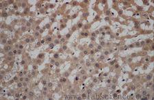 CALCRL / CGRP Receptor Antibody - Immunohistochemistry of paraffin-embedded Rat liver using CALCRL Polyclonal Antibody at dilution of 1:50.