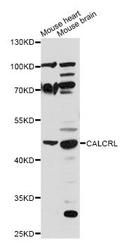 CALCRL / CGRP Receptor Antibody - Western blot analysis of extracts of various cell lines, using CALCRL antibody at 1:1000 dilution. The secondary antibody used was an HRP Goat Anti-Rabbit IgG (H+L) at 1:10000 dilution. Lysates were loaded 25ug per lane and 3% nonfat dry milk in TBST was used for blocking. An ECL Kit was used for detection and the exposure time was 90s.