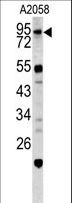 CALD1 / Caldesmon Antibody - Western blot of CALD1 antibody in A2058 cell line lysates (35 ug/lane). CALD1 (arrow) was detected using the purified antibody.