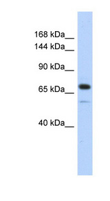 CALD1 / Caldesmon Antibody - CALD1 / Caldesmon antibody Western blot of Transfected 293T cell lysate. This image was taken for the unconjugated form of this product. Other forms have not been tested.