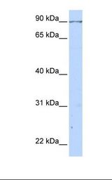 CALD1 / Caldesmon Antibody - 293T cell lysate. Antibody concentration: 1.0 ug/ml. Gel concentration: 12%.  This image was taken for the unconjugated form of this product. Other forms have not been tested.