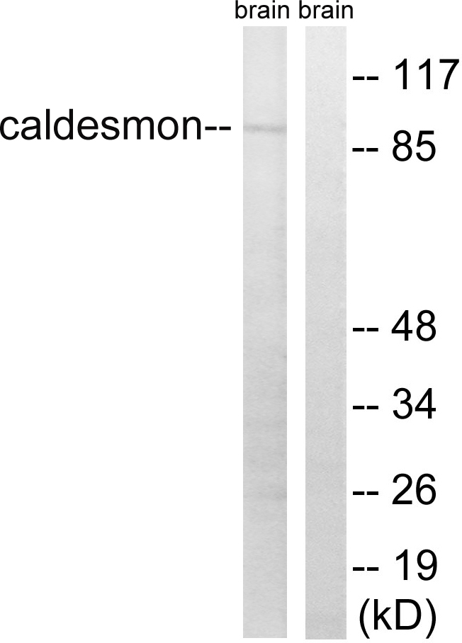 CALD1 / Caldesmon Antibody - Western blot analysis of lysates from mouse brain, using Caldesmon Antibody. The lane on the right is blocked with the synthesized peptide.