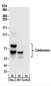 CALD1 / Caldesmon Antibody - Detection of Human Caldesmon by Western Blot. Samples: Whole cell lysate (50 ug) from HeLa, 293T, and Jurkat cells. Antibodies: Affinity purified rabbit anti-Caldesmon antibody used for WB at 0.1 ug/ml. Detection: Chemiluminescence with an exposure time of 30 seconds.