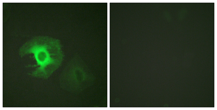 CALD1 / Caldesmon Antibody - Immunofluorescence analysis of HeLa cells, using Caldesmon Antibody. The picture on the right is blocked with the synthesized peptide.