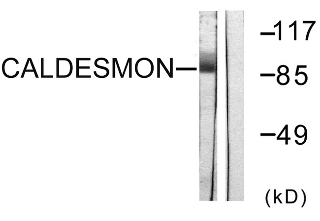 CALD1 / Caldesmon Antibody - Western blot analysis of lysates from HeLa cells, treated with EGF 200ng/ml 30', using Caldesmon Antibody. The lane on the right is blocked with the synthesized peptide.