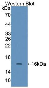 CALD1 / Caldesmon Antibody - Western Blot; Sample: Recombinant protein.