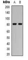 CALD1 / Caldesmon Antibody - Western blot analysis of Caldesmon (pS789) expression in HEK293T PMA-treated (A); NIH3T3 (B) whole cell lysates.
