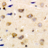 CALD1 / Caldesmon Antibody - Immunohistochemical analysis of Caldesmon (pS789) staining in human brain formalin fixed paraffin embedded tissue section. The section was pre-treated using heat mediated antigen retrieval with sodium citrate buffer (pH 6.0). The section was then incubated with the antibody at room temperature and detected using an HRP polymer system. DAB was used as the chromogen. The section was then counterstained with hematoxylin and mounted with DPX.