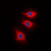 CALD1 / Caldesmon Antibody - Immunofluorescent analysis of Caldesmon (pS789) staining in HeLa cells. Formalin-fixed cells were permeabilized with 0.1% Triton X-100 in TBS for 5-10 minutes and blocked with 3% BSA-PBS for 30 minutes at room temperature. Cells were probed with the primary antibody in 3% BSA-PBS and incubated overnight at 4 deg C in a humidified chamber. Cells were washed with PBST and incubated with a DyLight 594-conjugated secondary antibody (red) in PBS at room temperature in the dark. DAPI was used to stain the cell nuclei (blue).