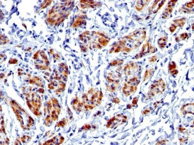 CALD1 / Caldesmon Antibody - Formalin-fixed, paraffin-embedded human Uterus stained with Caldesmon Rabbit Recombinant Monoclonal Antibody (CALD1/1424R).