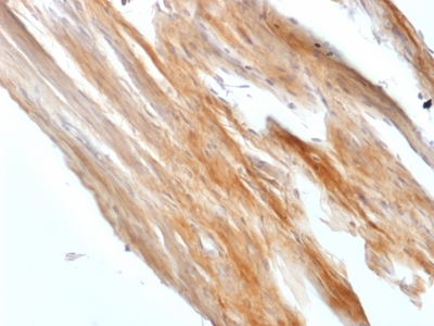 CALD1 / Caldesmon Antibody - Formalin-fixed, paraffin-embedded Rat Uterus stained with Caldesmon Rabbit Recombinant Monoclonal Antibody (CALD1/1424R).