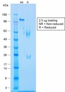 CALD1 / Caldesmon Antibody - SDS-PAGE Analysis Purified Caldesmon Rabbit Recombinant Monoclonal Antibody (CALD1/1424R). Confirmation of Purity and Integrity of Antibody.
